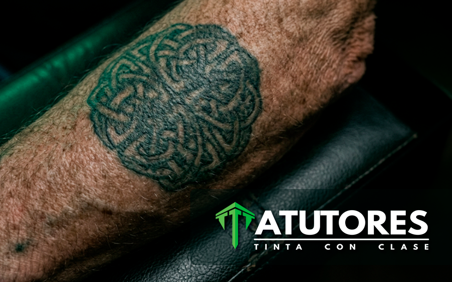¿Por qué el tatuaje se expande con los años?
